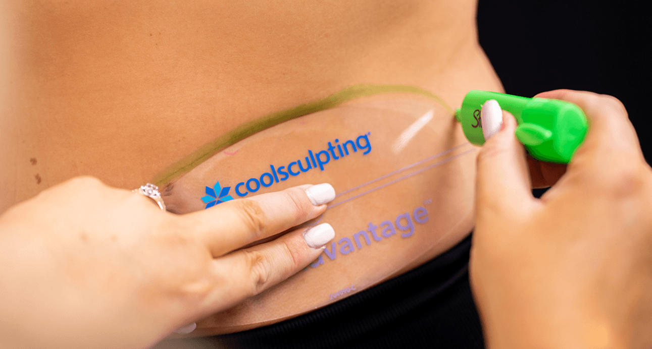 CoolSculpting Armpit Fat  Discover Details for CoolSculpting