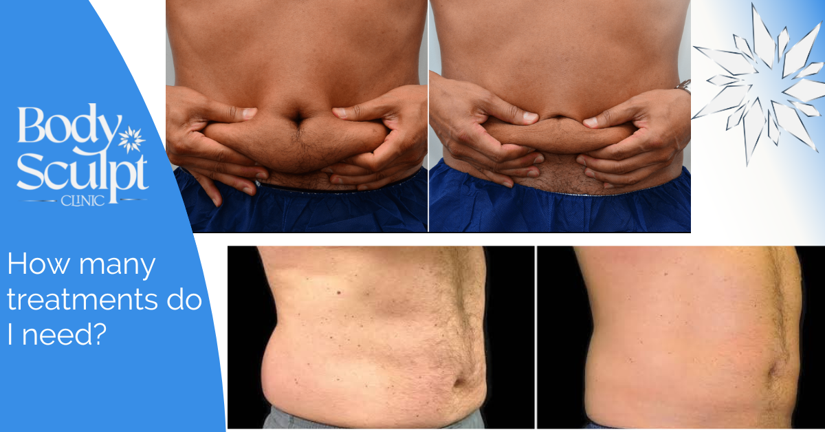 HOW MUCH DOES COOLSCULPTING COST NEAR YOU visual data 6